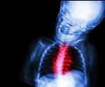 What is Congenital Heart Disease?