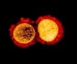 Heat suggested as a therapeutic intervention in COVID-19