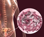 Oral sex can trigger bacterial vaginosis
