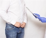 Balanitis: An Overview