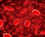 What is Methemoglobinemia?