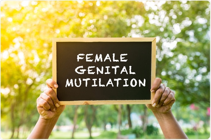 FGM FGM