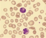 Treatment for Myelodysplastic Syndromes