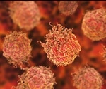 Developing a blood test for prostate cancer