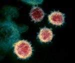 Single-molecule imaging of SARS-CoV-2 spikes on virus particles