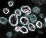 No discernable difference in SARS-CoV-2 viral loads of young children versus older children and adults