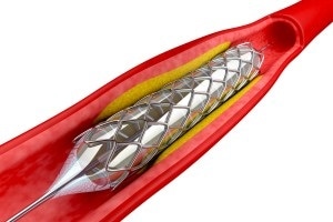 ISO 10993-18: Variability in Medical Devices
