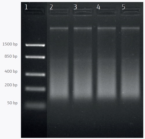 Extracting DNA from Food Samples Agarose gel electrophoresis of DNA extracted from frozen shrimp samples. Lane 1: DNA ladder; lanes 2–5: Samples 1–4.
