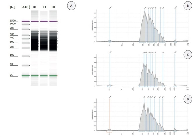 Validation of HaloPlex enrichment by 2200 TapeStation analysis. (A) Gel Image of 3 analysed samples. Lane A1: High Sensitivity Ladder, Lane B1: patient sample 115, Lane C1: patient sample 116, Lane D1: patient sample 117. Electropherograms (B-D): patient sample 115 (B), patient sample 116 (C), patient sample 117 (D).
