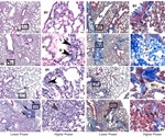 Keto diet could be beneficial for elderly COVID-19 patients