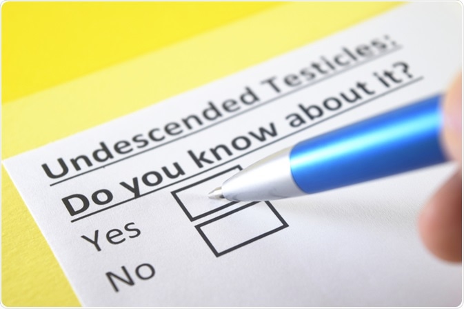 Undescended Testicles Undescended Testicles
