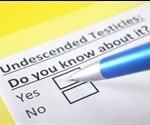 Symptoms and Causes of Undescended Testicles