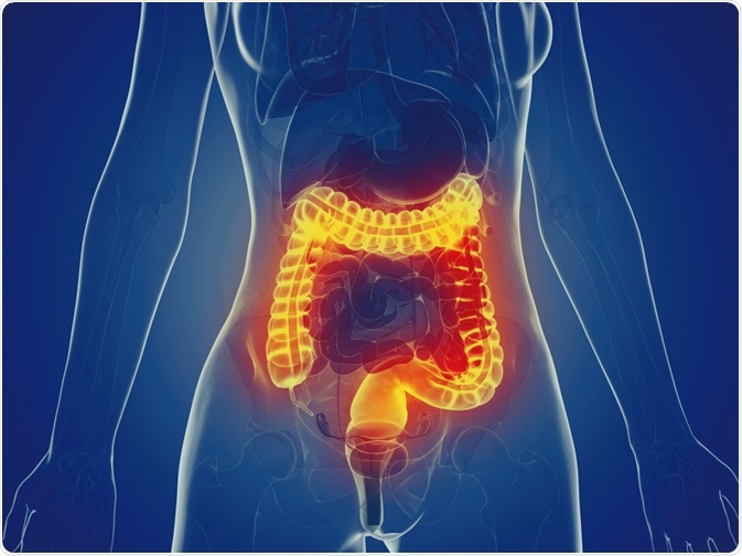 IBD IBD