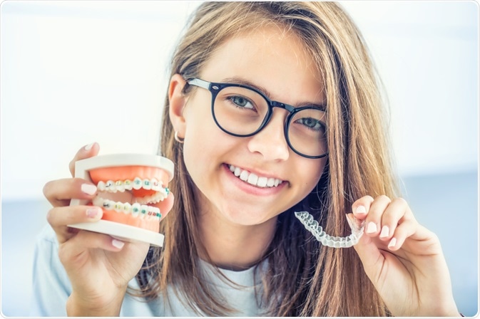 Braces Braces