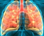 What are Lung Organoids?
