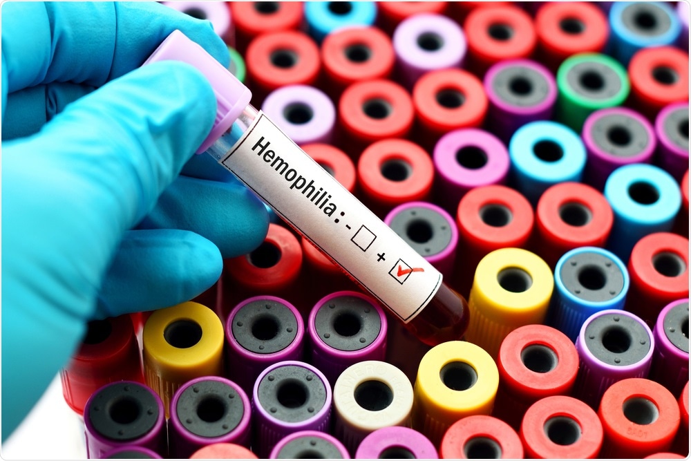 Hemophilia