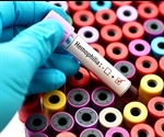 Providing personalized care for bleeding disorders