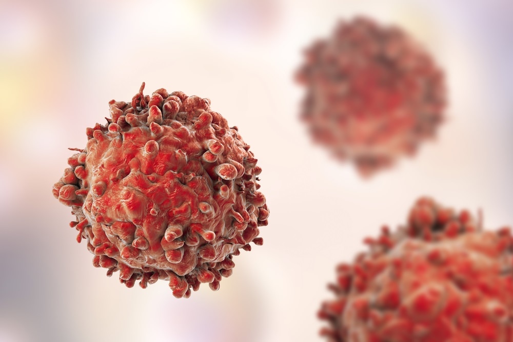 Challenges in High Complexity Flow Cytometry