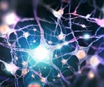 What is Mononeuritis Multiplex?