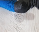 Causes of Nocturnal Enuresis (Bedwetting)