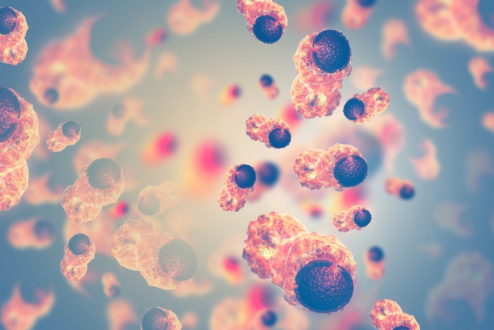 Challenges in High Complexity Flow Cytometry