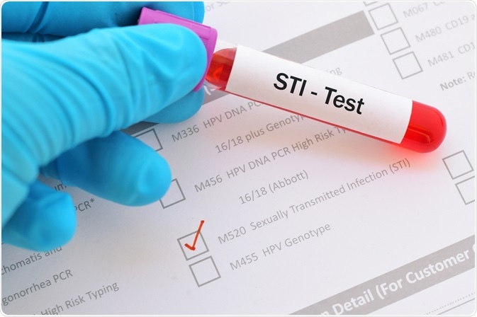 STI STI