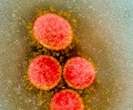 Prolonged shedding and multiple mutations 154 days after initial SARS-CoV-2 diagnosis reported