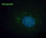 Vimentin could be a major co-factor that aids SARS-CoV-2 infection