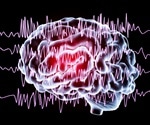 Sudden Unexpected Death in Epilepsy (SUDEP)