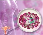 Vaginitis Treatment