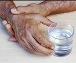 Uncovering Hidden Symptoms: Hallucinations and Delusions in Parkinson’s Disease
