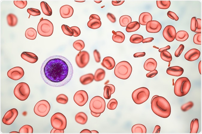 iron deficiency