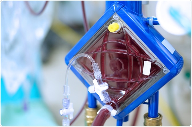 ECMO