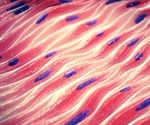 What is Centronuclear Myopathy?