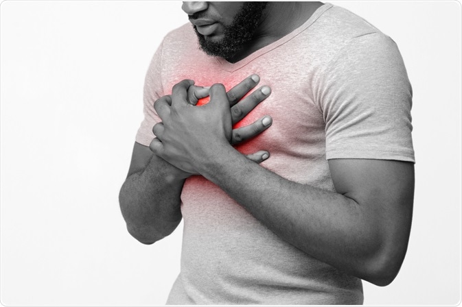 acid reflux