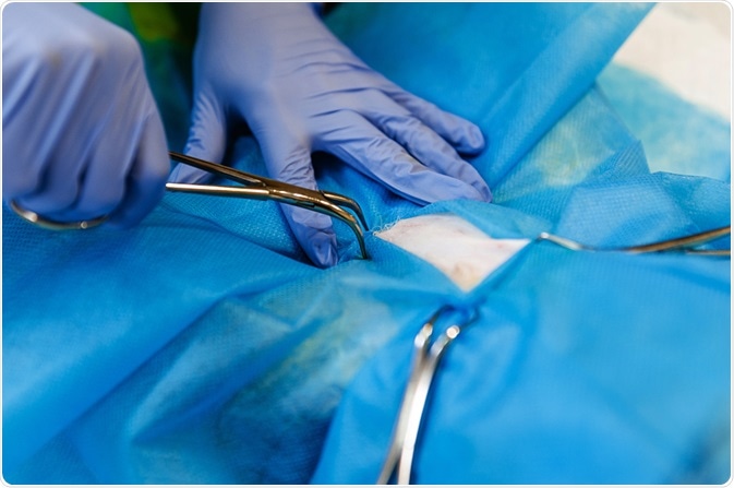 abdominal surgery