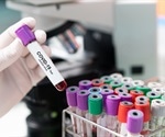 Using Flow Cytometry to Identify Vaccine Targets for SARS-CoV-2