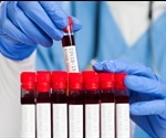 Serological Testing for COVID-19