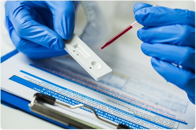 serological test