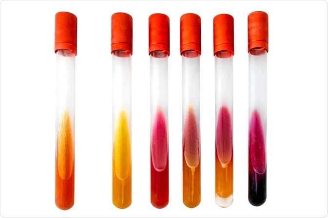biochemical test