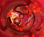 Researchers immunoengineer nanobead system for circulating tumor cell detection