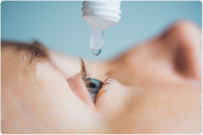 Sjogren’s Syndrome