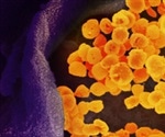 REGEN-COV shown to reduce risk of COVID-19–related hospitalization or death from any cause