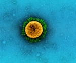 SARS-CoV-2 vaccination lowers risk of several outcomes after breakthrough infection