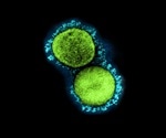 What makes SARS-CoV-2 variants more virulent?