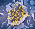 Using a new public antibody to understand SARS-CoV-2 neutralization