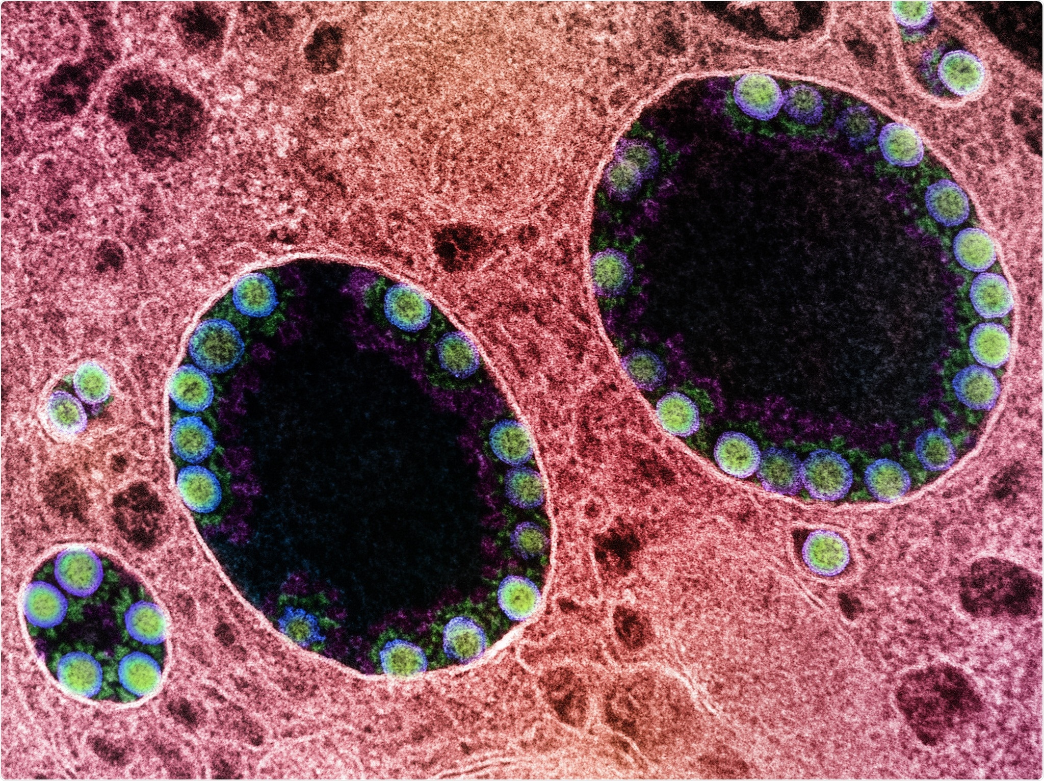 Study: Generation time of the Alpha and Delta SARS-CoV-2 variants. Image Credit: NIAID
