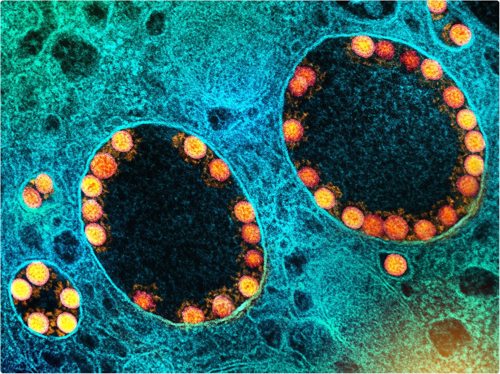 Study: Effectiveness of Covid-19 Vaccines in the United States Over 9 Months: Surveillance Data from the State of North Carolina. Image Credit: NIAID