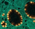 Anti-rheumatic drug as a potential candidate for treating COVID-19