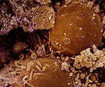 Small portion of COVID-19 patients infectious long-term